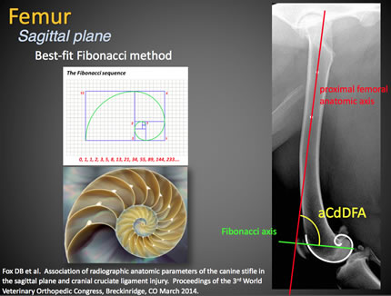 Femur Sagittal plane
